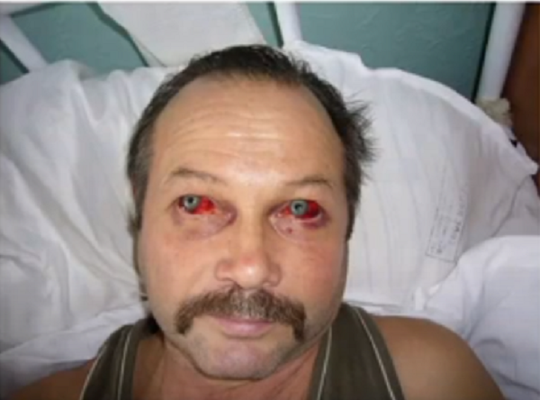 Мышиная лихорадка. В российских регионах растет число заболевших