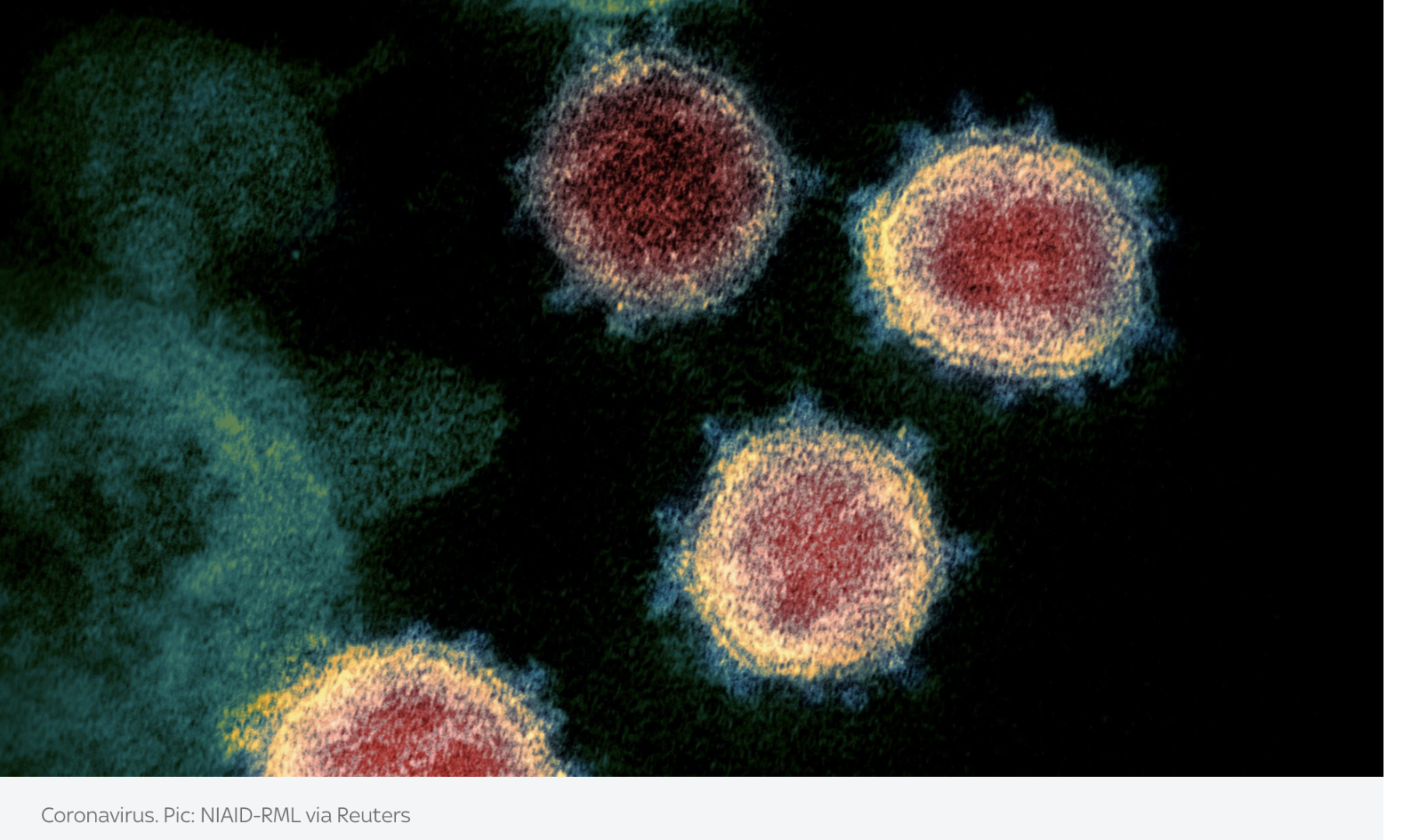 COVID-19: Новый вариант распространяется по Великобритании - на фоне роста общего числа случаев заболевания