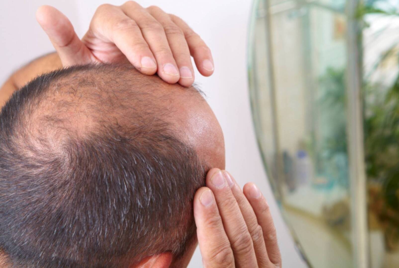 Как избавиться от лысины?