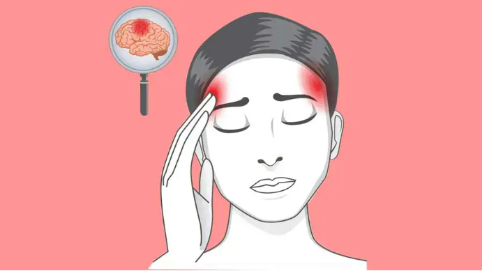 Как распознать ранние признаки инсульта и почему каждая секунда на счету