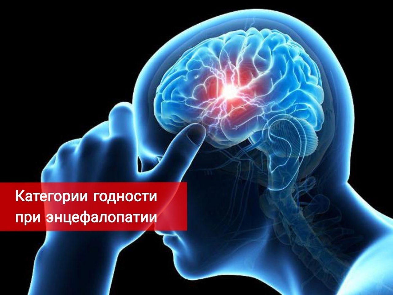Категории годности при энцефалопатии