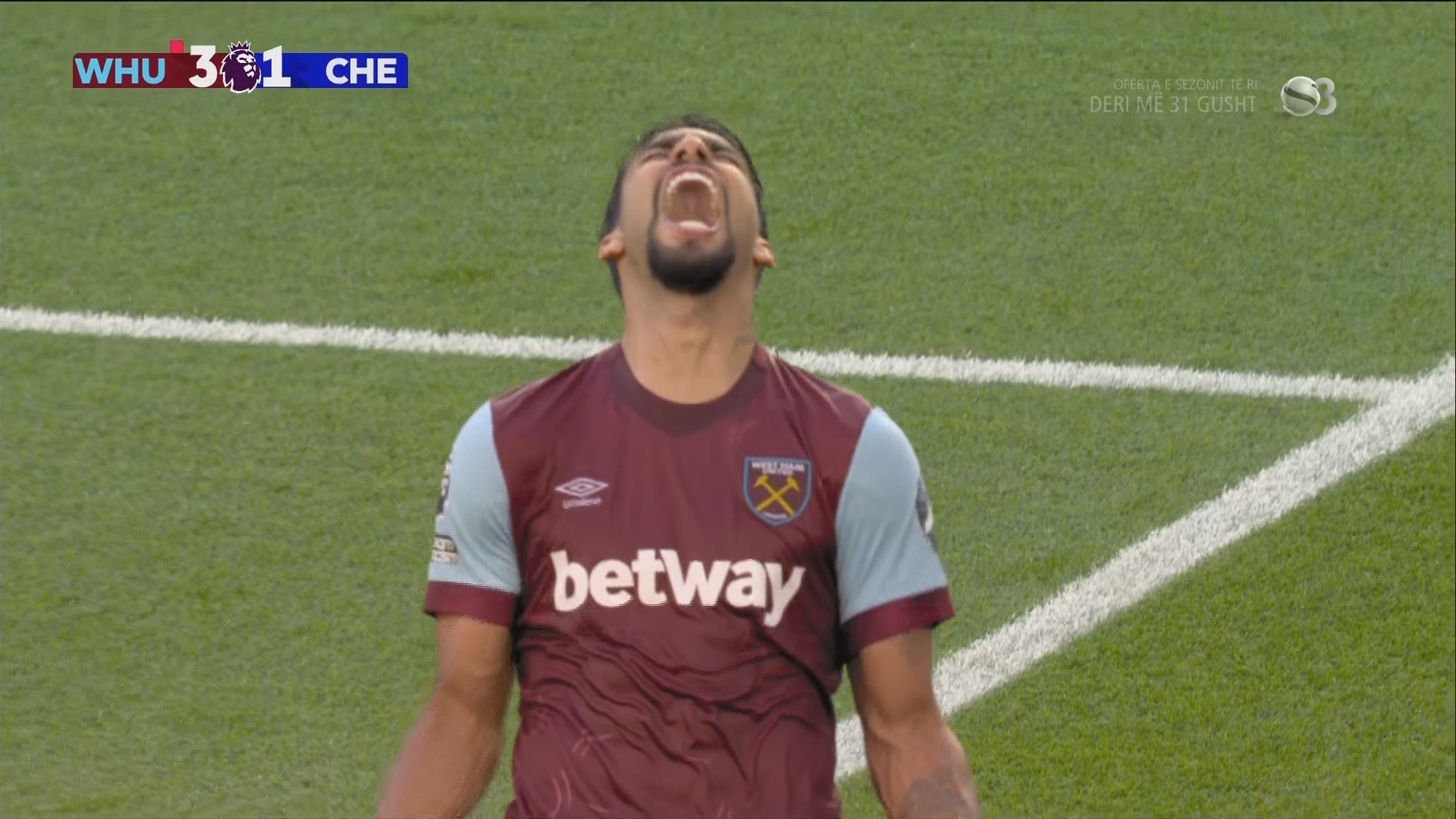 Синдром Шуры Балаганова