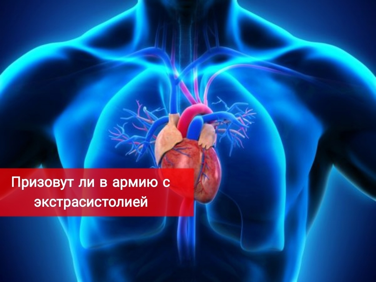 Призовут ли в армию с экстрасистолией