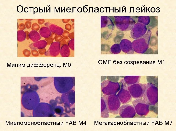 "Беспомощность медицины: случай, показывающий, как небрежность и халатность врачей может погубить жизнь человека. История из личной жизни"