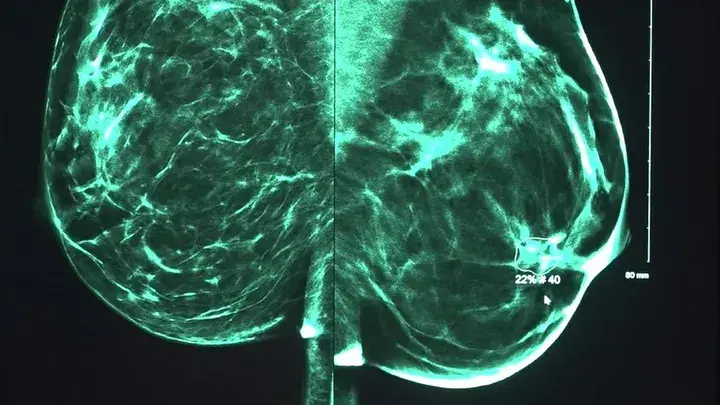 Я люблю искусственный интеллект, потому что он добавит десятилетия к нашей жизни