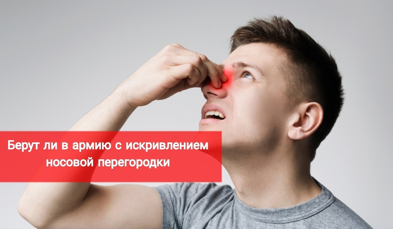 Берут ли в армию с искривлением носовой перегородки