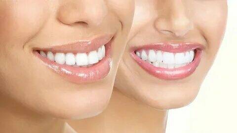 Эволюция зубных протезов: чем заменяли зубы наши предки?