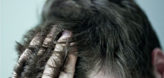 Многие люди хотят более густые волосы. Разница между плотностью волос и густыми волосами