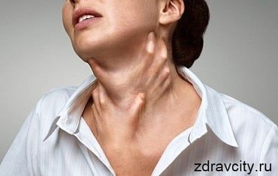 РАЗОБЛАЧЕНИЕ ангионевротического отека: более глубокое погружение в отек КВИНКЕ под поверхностью