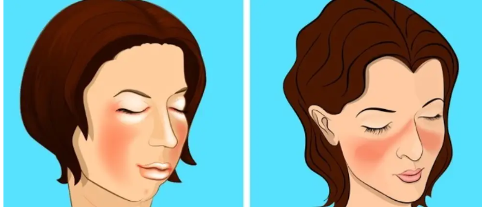 5 заболеваний, которые часто путают с другими заболеваниями