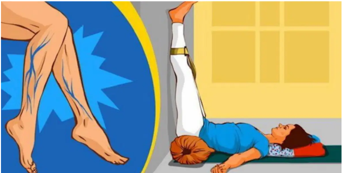 Лучшие позы йоги, которые помогут улучшить кровообращение и избавиться от варикозного расширения вен