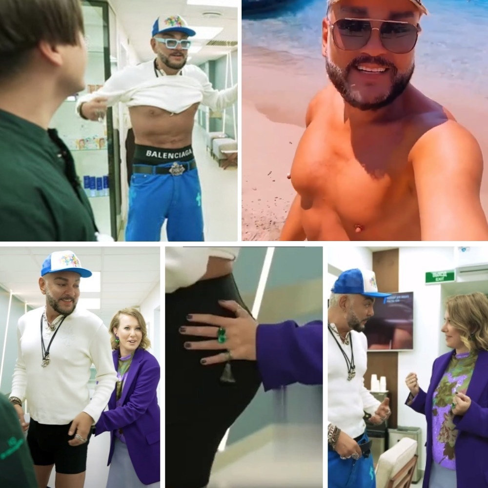 Ягодицы под Лупой: Как Ксения Собчак Рассмешила Филиппа Киркорова в Мире Пластики