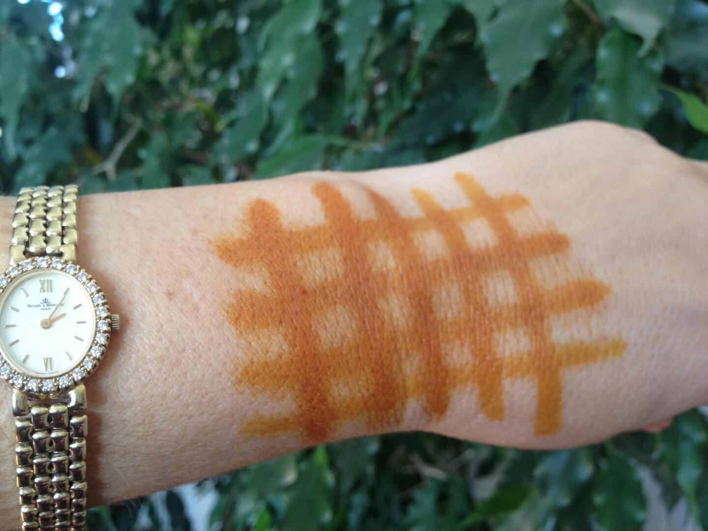 Зачем нужна йодная сетка: Бабушкины методы и их эффективность