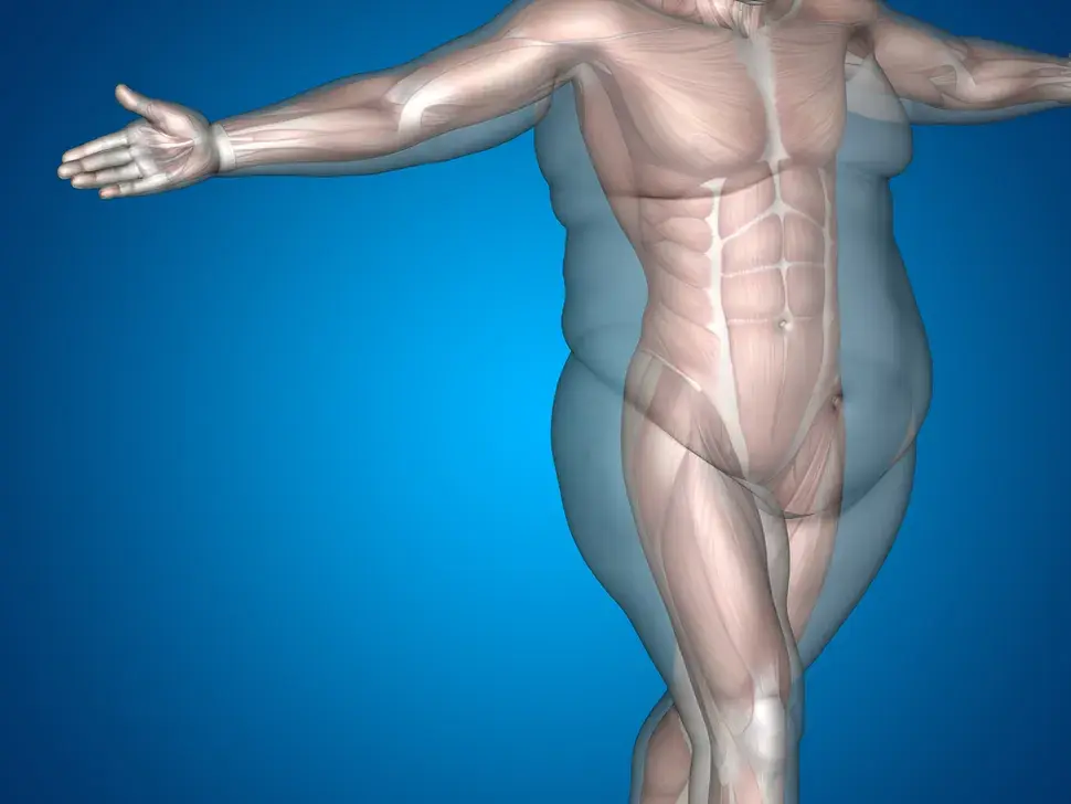 Ожирение: Причины, осложнения и лечение