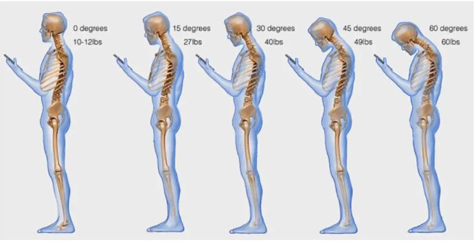 Знаете ли вы, что текстовые сообщения вызывают боль в шее? Вот как лечить текстовые сообщения на шее
