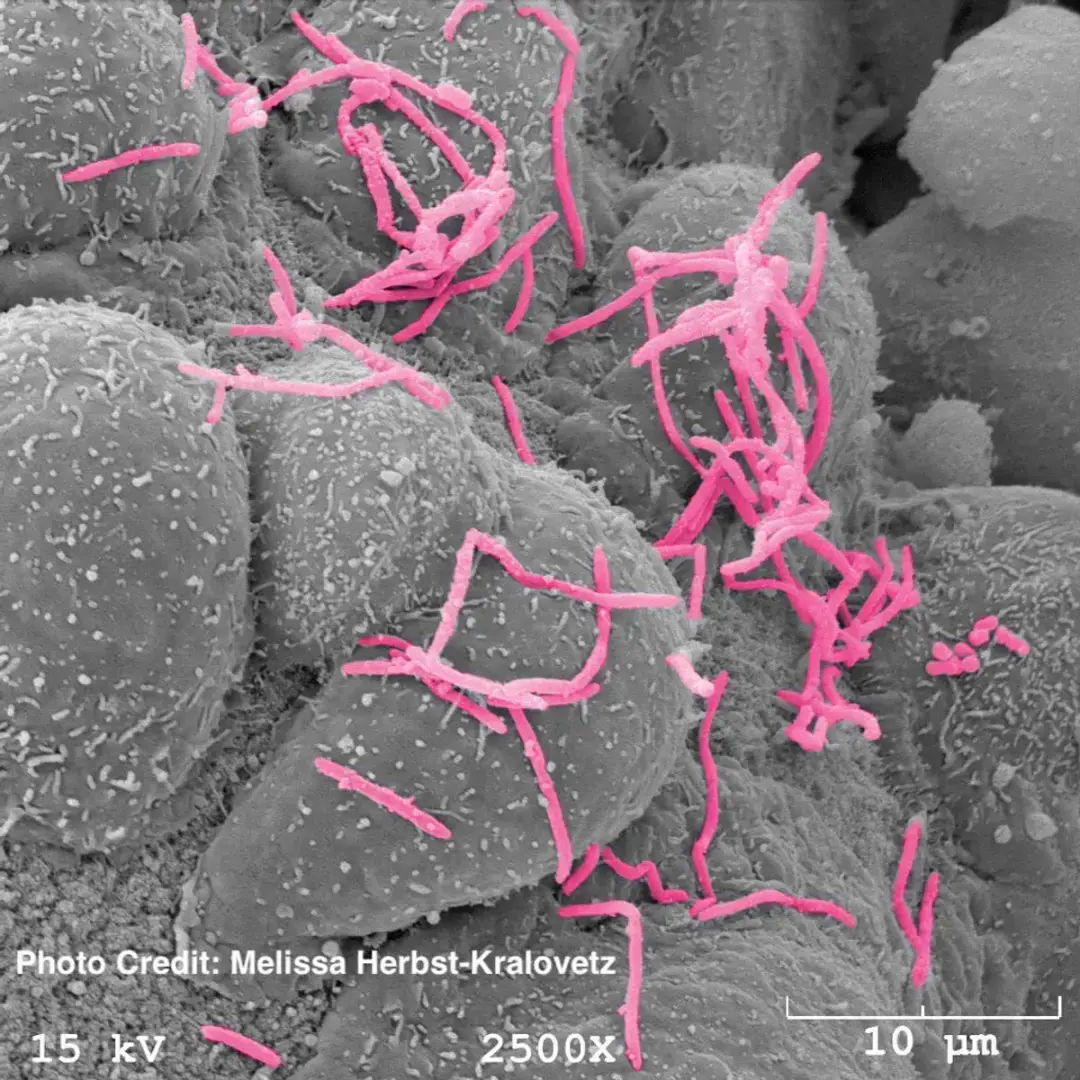Вагинальный микробиом наконец-то получает признание