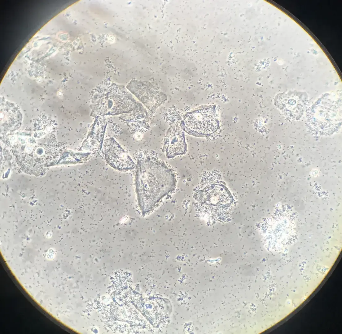 Вагинальный микробиом наконец-то получает признание