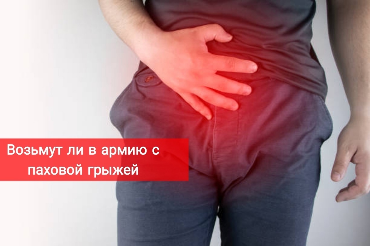 Возьмут ли в армию с паховой грыжей