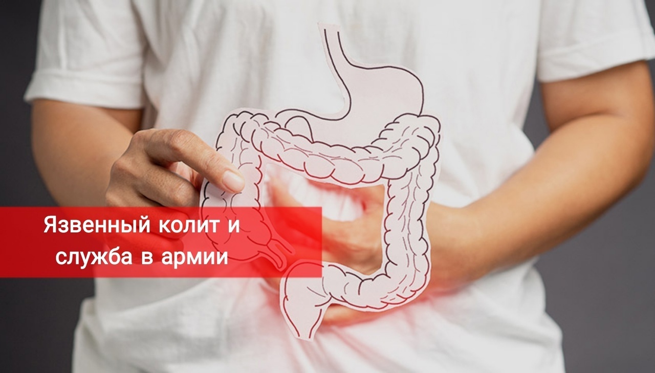 Язвенный колит и служба в армии