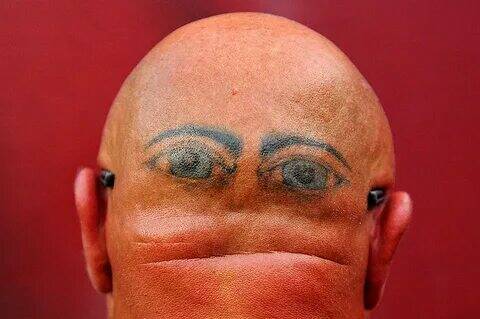 Какая мутация делает мужчин лысыми.