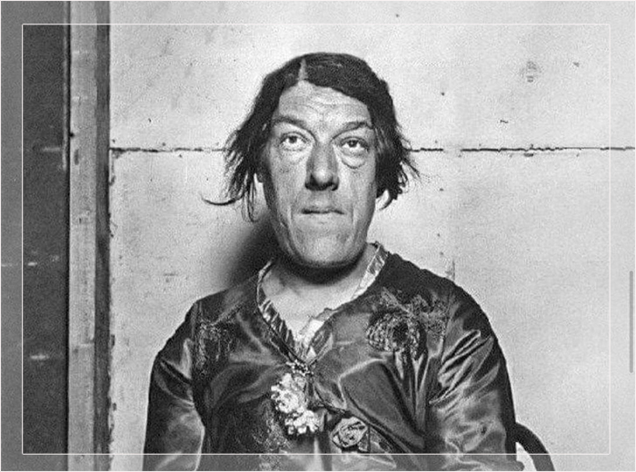 🎇"Самая уродливая женщина в мире". 🎇Трагическая история Мэри Энн Беван (Видео)