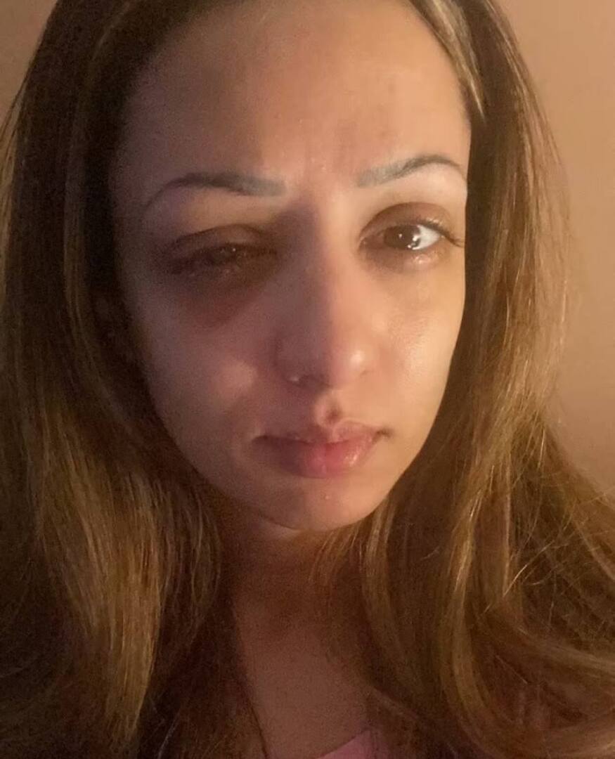 Девушка из Британии ослепла от похода в общественный бассейн.