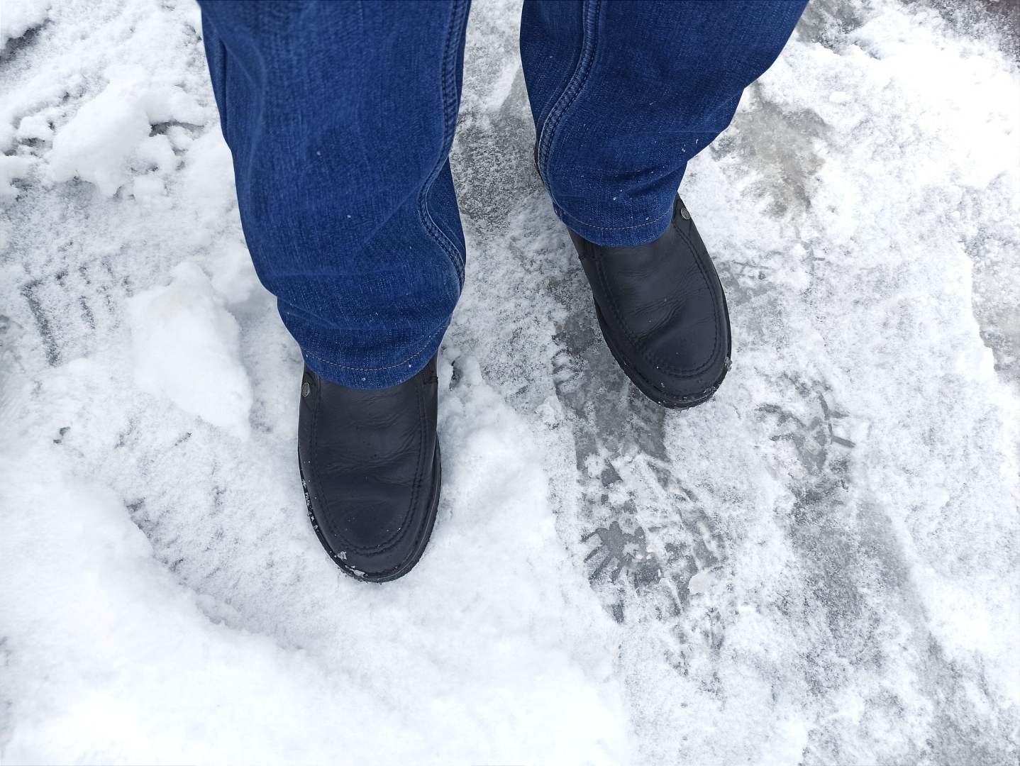 Поскользнулся, упал, очнулся – гипс. Кто виноват? В каком размере требовать компенсацию за падение в гололед?