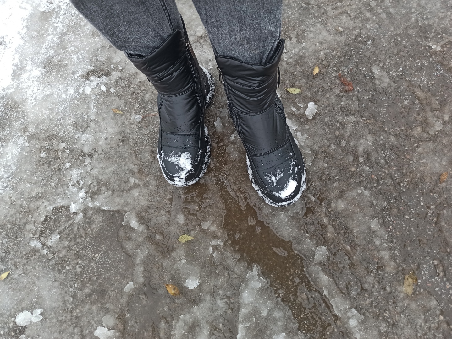 Поскользнулся, упал, очнулся – гипс. Кто виноват? В каком размере требовать компенсацию за падение в гололед?