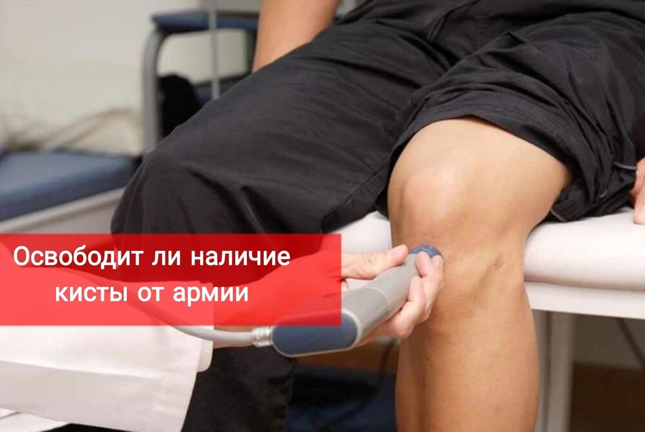 Освободит ли наличие кисты от армии