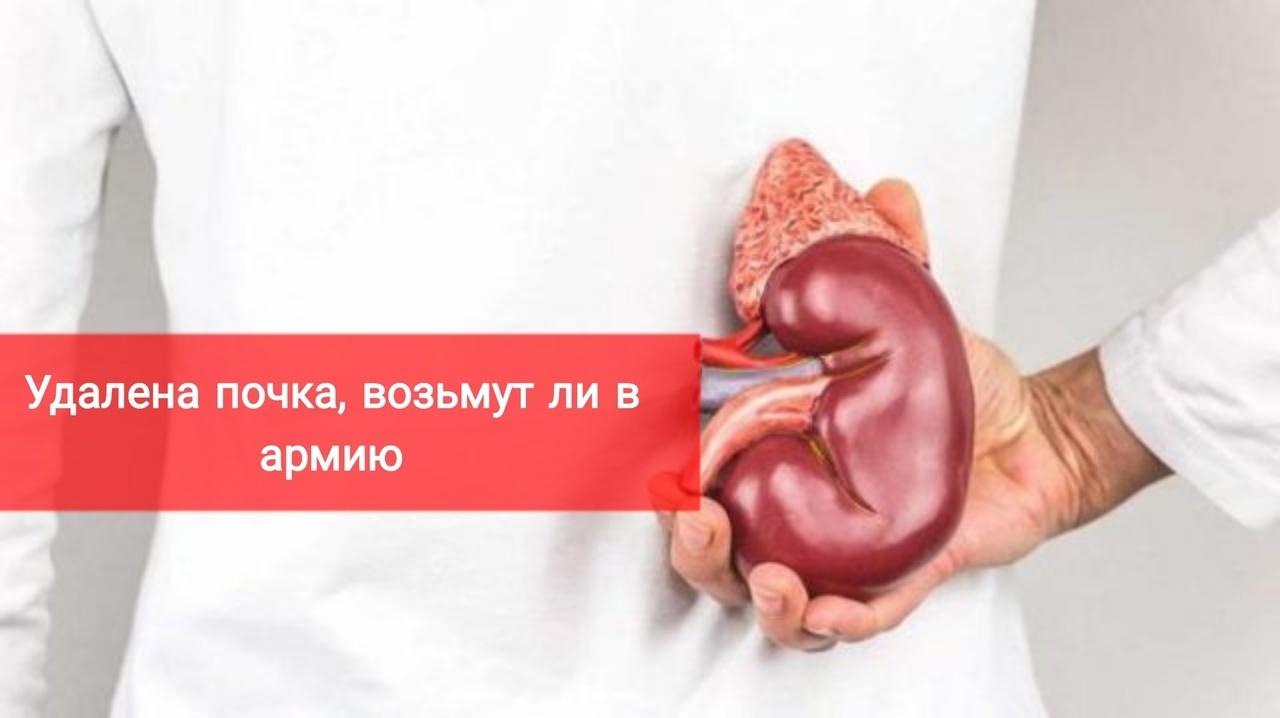 Удалена почка. Возьмут ли в армию