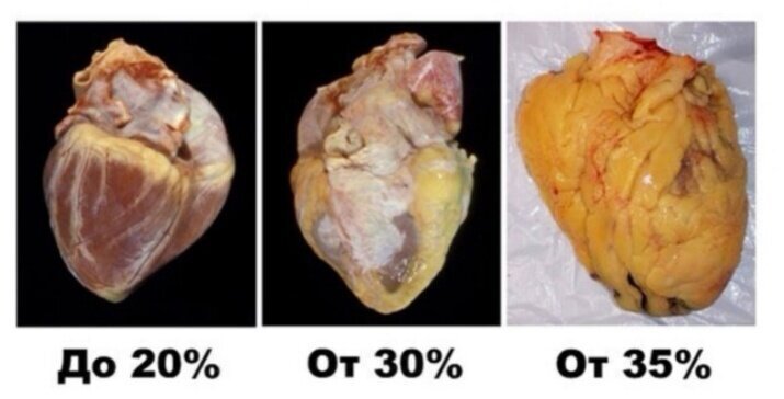 Правильное питание. Что это на самом деле