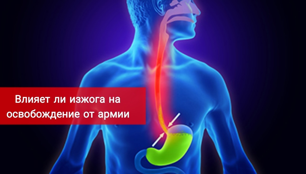 Берут ли призывников в армию с изжогой