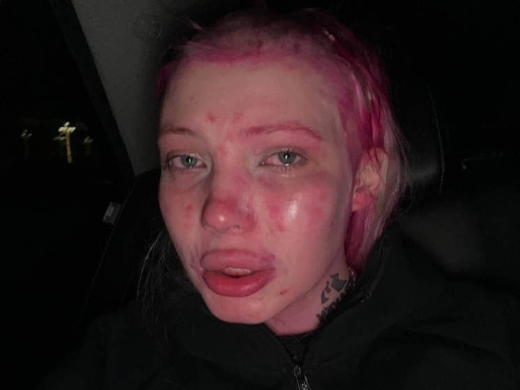 В Ереване облили марганцовкой и насильно побрили скандальную российскую блогершу