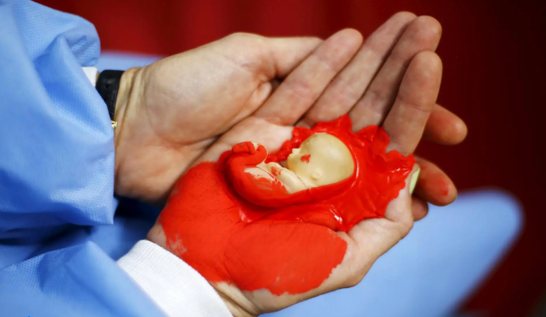 Аборт в России: право женщины или убийство?