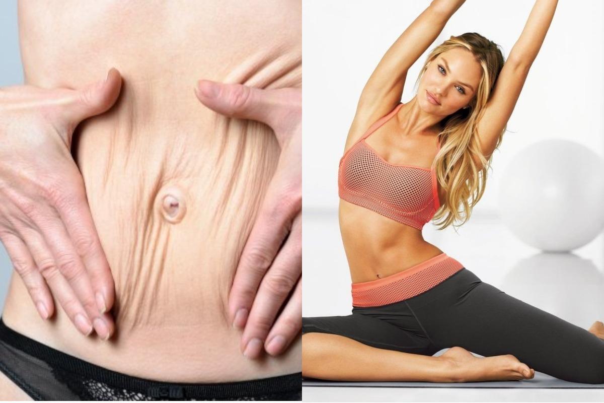 "У вас избыток кожи? Есть варианты лечения".