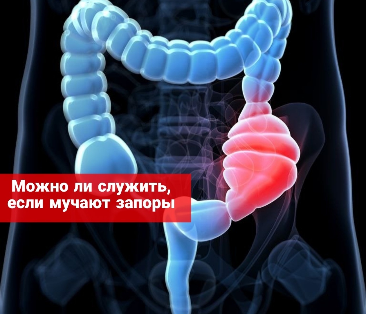 Можно ли служить, если мучают запоры