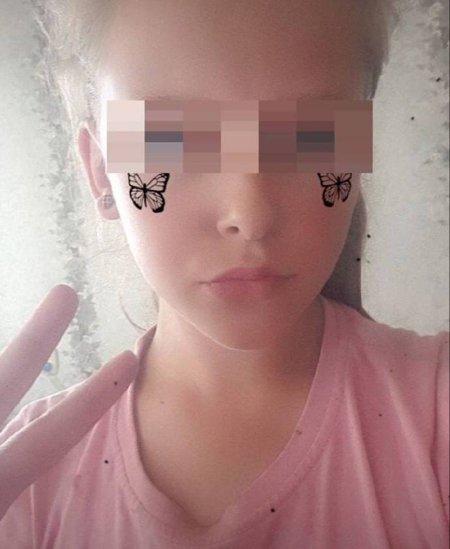 Зарядное устройство взорвалось и оторвало кисти рук школьнице