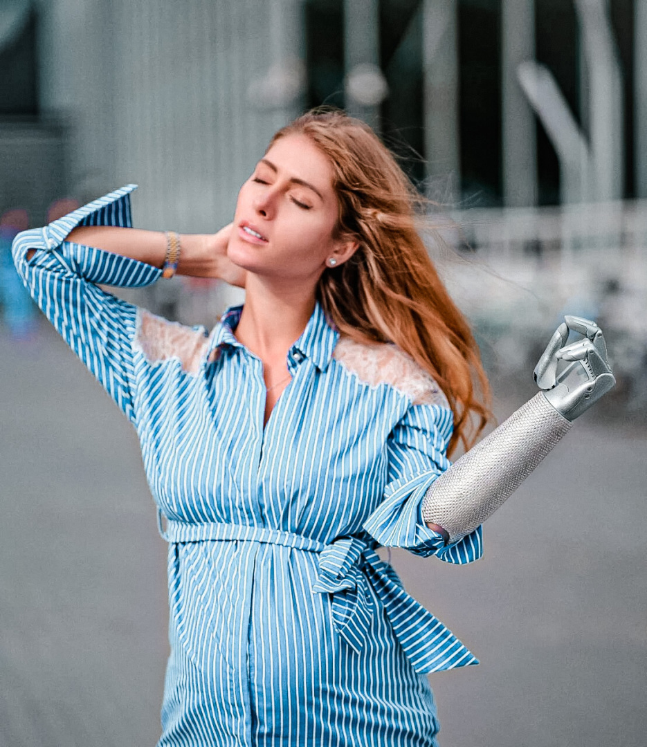 "Вероника: от протеза к вдохновению..."