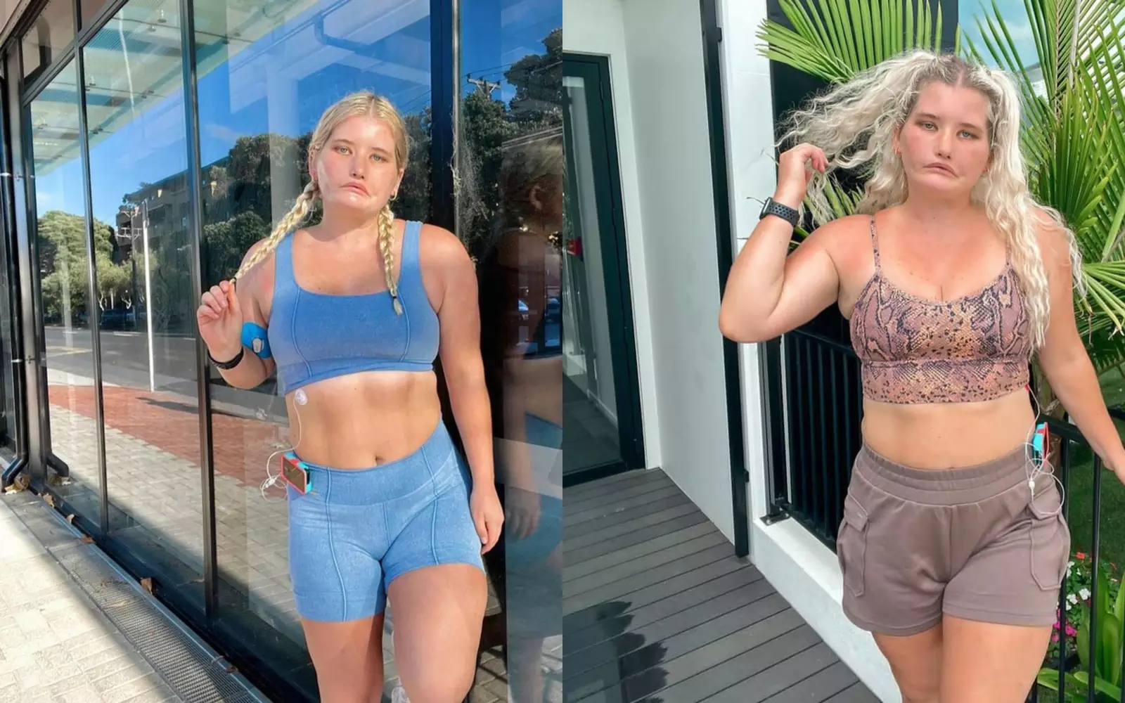 Царевна-несмеяна: как живёт девушка с синдромом Мёбиуса, которая не улыбнулась ни разу в жизни