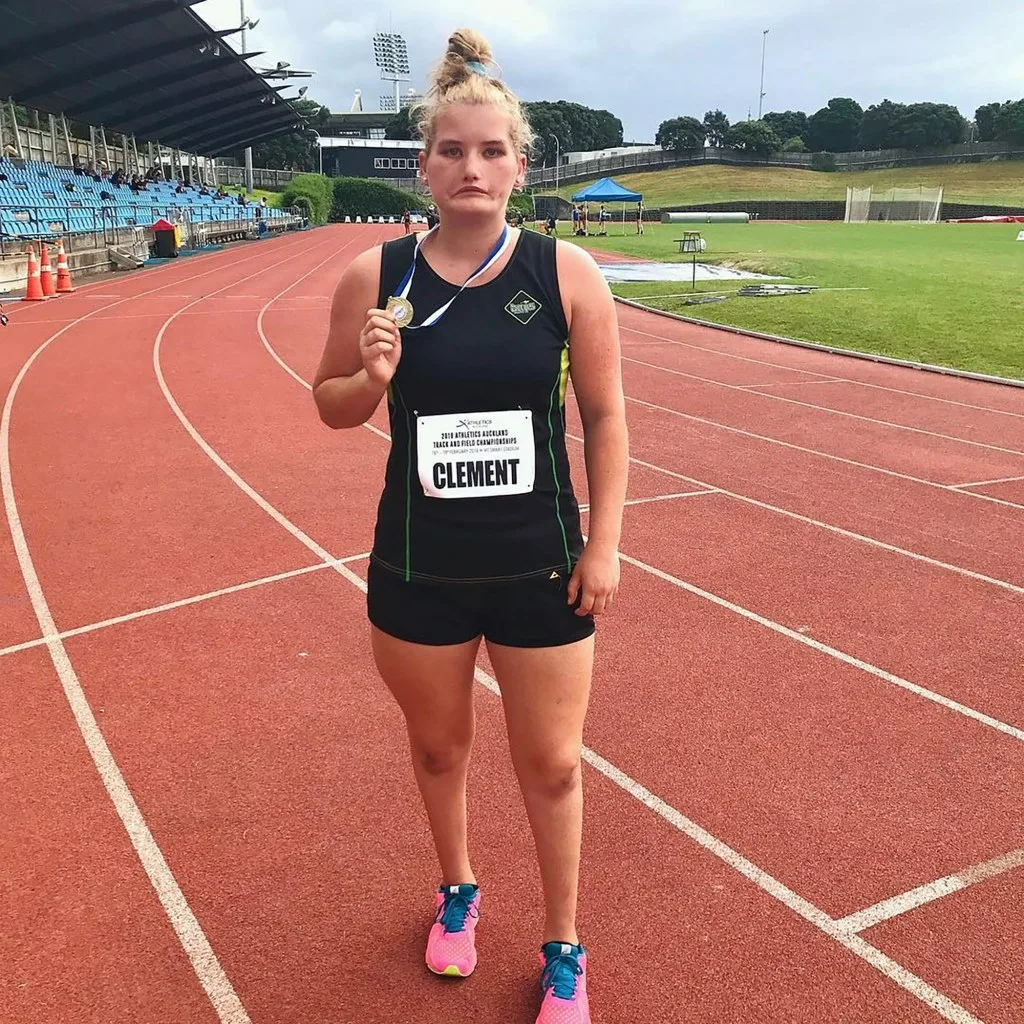 Царевна-несмеяна: как живёт девушка с синдромом Мёбиуса, которая не улыбнулась ни разу в жизни