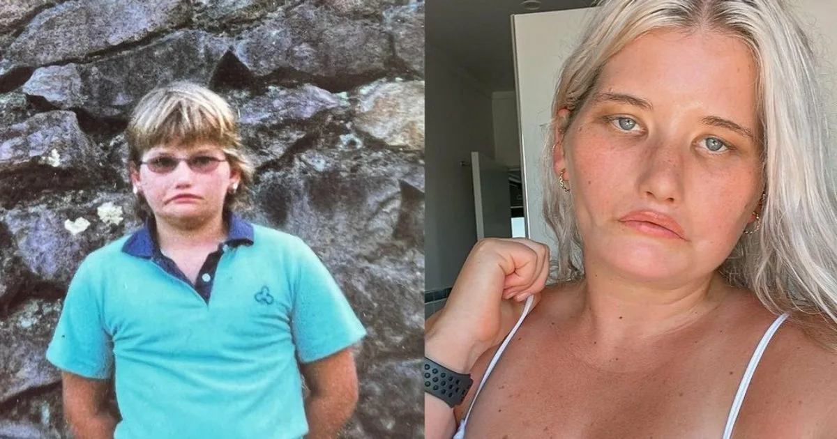 Царевна-несмеяна: как живёт девушка с синдромом Мёбиуса, которая не улыбнулась ни разу в жизни