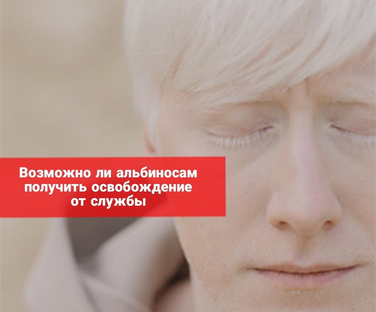 Берут ли в армию альбиносов