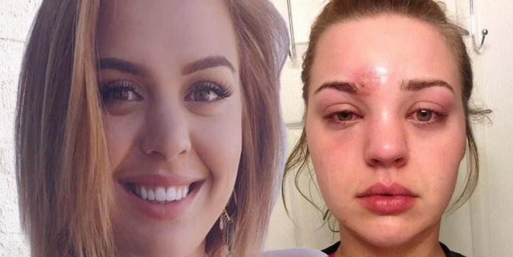 Опасная одержимость красотой: как некачественная косметика привела к трагедии