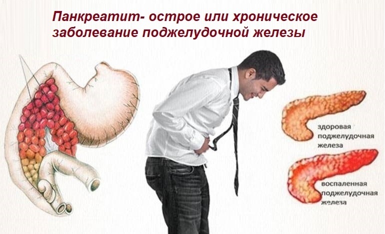 Панкреатит: скрытая опасность и роль питания в его развитии