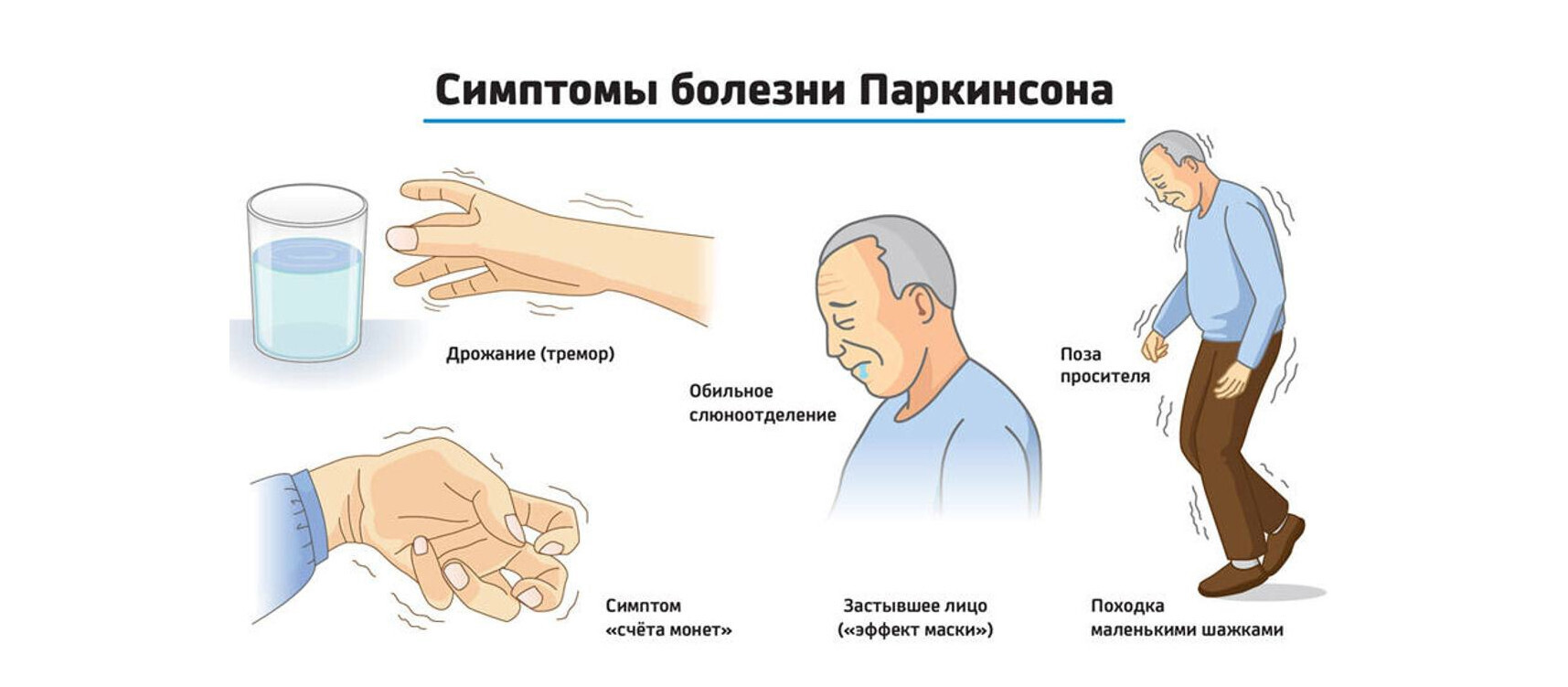 Болезнь Паркинсона. Болезнь паркинсонизм. Болезнь Паркинсона тремор.