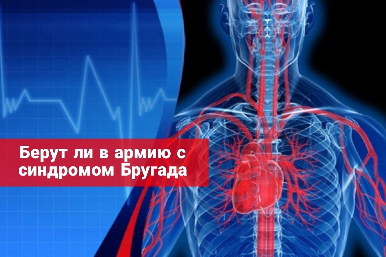 Берут ли в армию с синдромом Бругада | Васильев Егор Игоревич, 26 ...