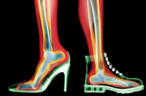 Девочки и каблуки: нет и еще раз нет!