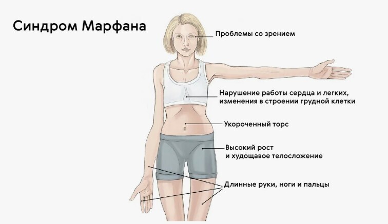 Иридодиагностика. Процедура определения болезней по глазам.