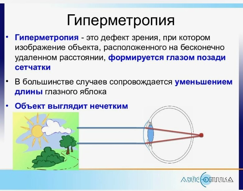 Гиперметропия слабой стенки