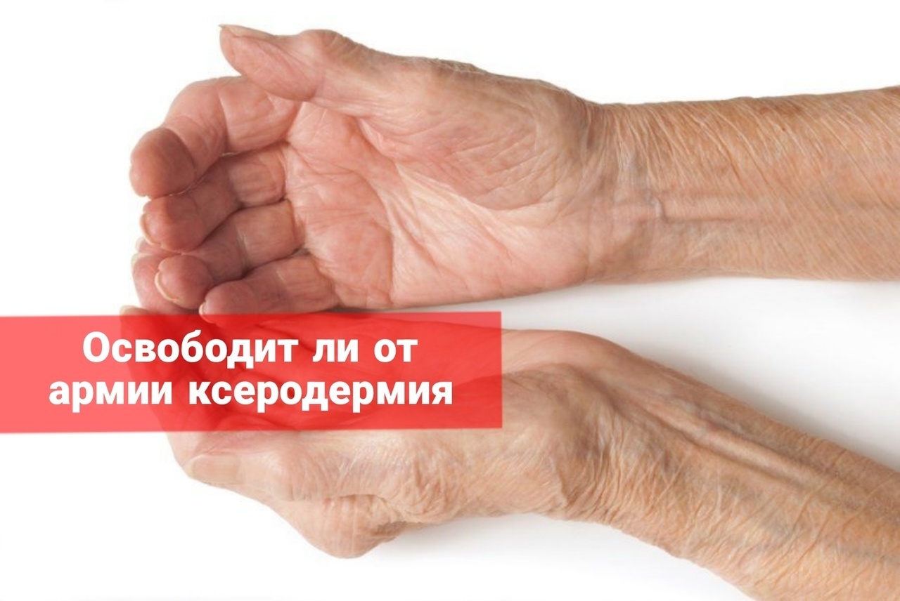 Освободит ли от армии ксеродермия